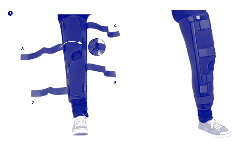 Имобилизираща шина за коляно