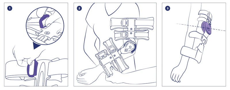 Постоперативна шина за обездвижване на лакът